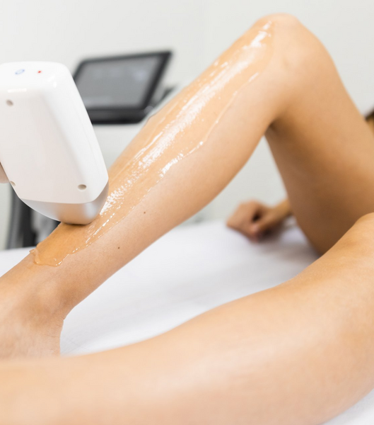 laser hair removal