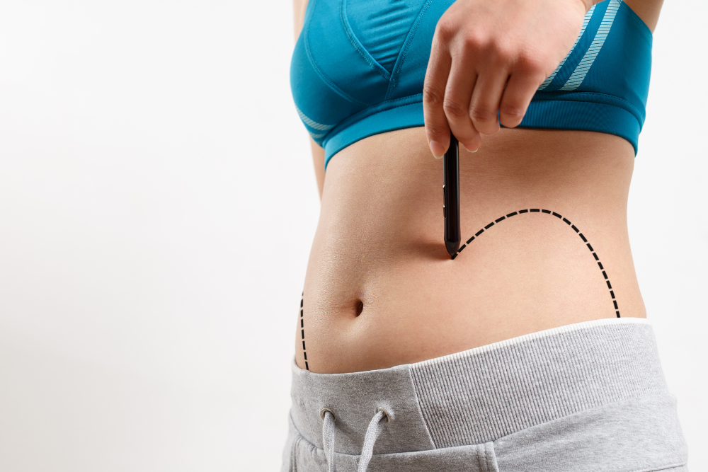 Liposuction Near Me: A Path To Confidence With Face Amorè