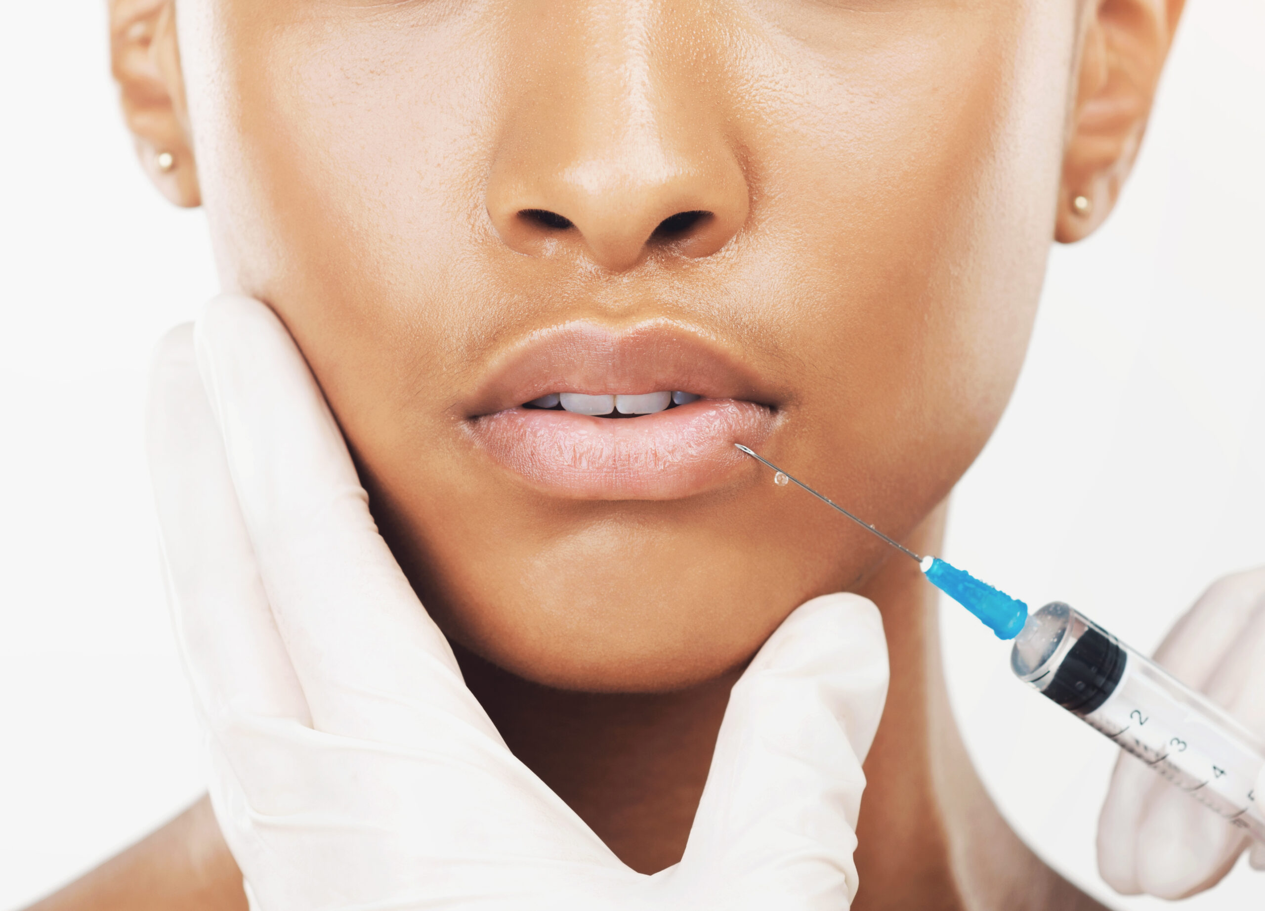 Dermal Fillers Near Me