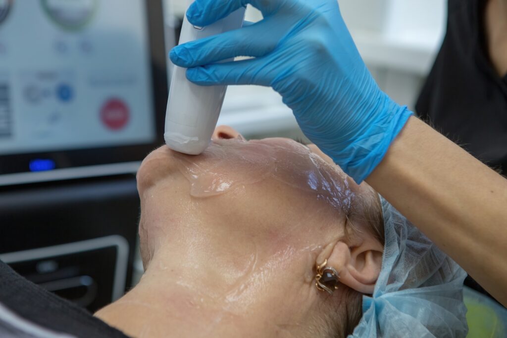Chemical Skin Resurfacing